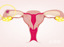 试管检查卵巢功能：何时做最好?多久出结果?