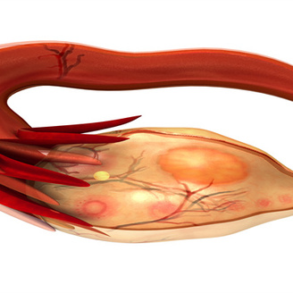 试管输卵管造影检查的费用与疼痛程度全面浅析
