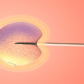 双侧卵巢多囊样改变是什么意思?卵巢多囊可以做试管婴儿吗?