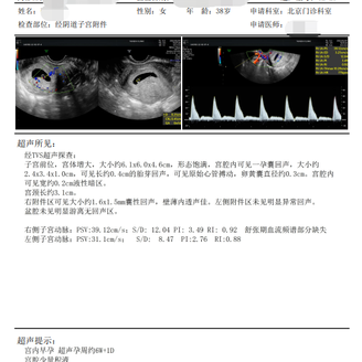 2次试管后不良妊娠，38岁的她做泰国试管一次成功！