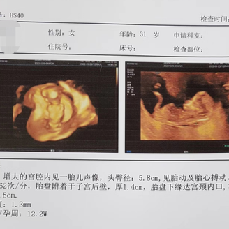 31岁AMH0.03，她竟然自卵怀上小公主