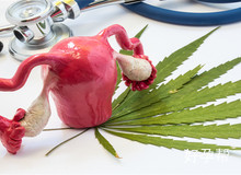 女性子宫内膜异位：解析与治疗