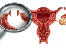 女性为什么会子宫内膜增厚?怎么治疗最好?