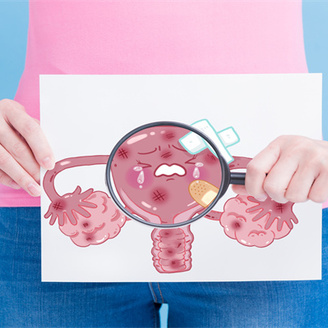 女性多囊卵巢是什么原因引起的?怎么治疗比较好?