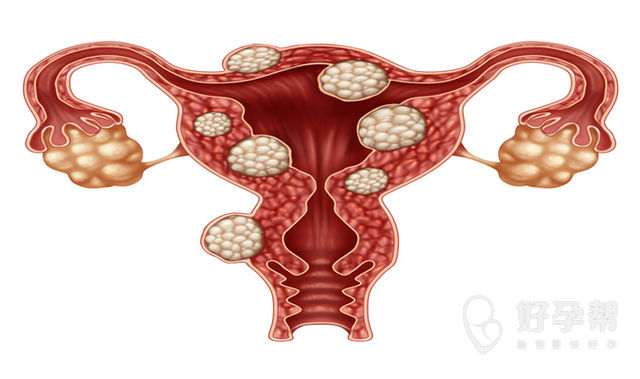 输卵管疼是什么原因引起的?吃什么药效果好?