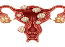输卵管疼是什么原因引起的?吃什么药效果好?
