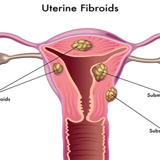 女性宫寒的成因及怀孕可能性探讨
