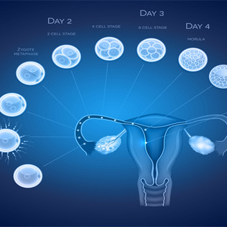 卵泡不成熟的原因及其对试管移植的影响