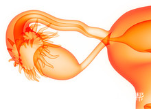 女性子宫腺肌症的症状及对受孕的影响