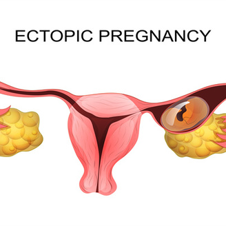 通完输卵管需要休息几天?疏通后多久可以同房?