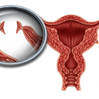 女性宫腔镜检查：手术性质与麻醉需求