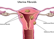 试管科普：子宫内膜标准厚度与试管婴儿移植