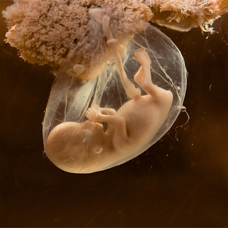 专家解读：试管移植成功的十个征兆!提前知晓移植结果