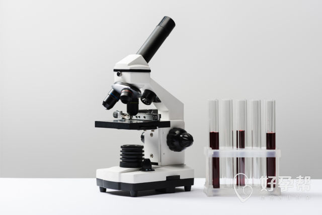 多囊卵巢患者必读：为何医生建议先调理再选择试管婴儿？