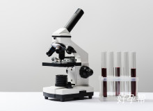 多囊卵巢患者必读：为何医生建议先调理再选择试管婴儿？