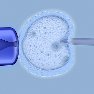 东莞试管婴儿费用包含哪些项目？2025最新价目明细及避坑指南