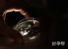 2025山东多囊试管婴儿费用大揭秘：从3万到20万的费用差异解析