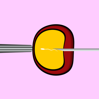 试管移植全过程经验分享：亲身经历从检查到成功的详细记录与心得