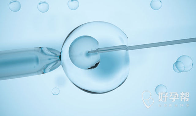 做宫腹腔镜联合手术需要多久？一天时间够不够？