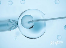 做宫腹腔镜联合手术需要多久？一天时间够不够？