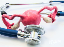 生育问答：为什么输卵管会粘连?这四大因素千万别忽视!