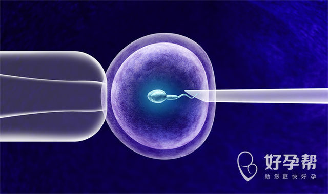 试管科普：试管前夫妻双方需要做的检查项目全在这儿了!