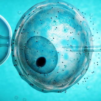 高龄女性试管婴儿：第二代与第三代技术的抉择