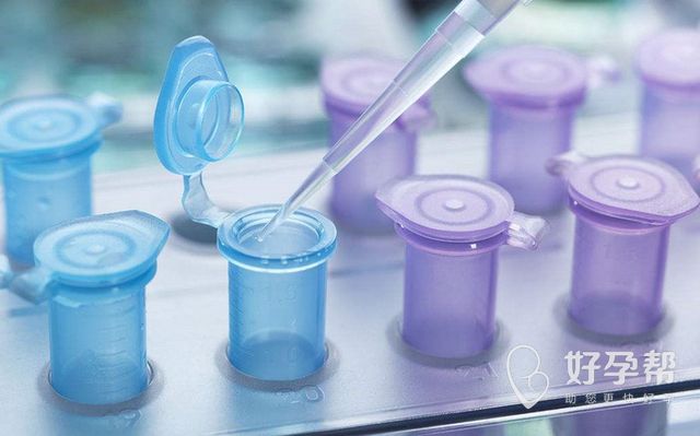 35岁弱精症如何治疗?怎么调理才可以正常要孩子?