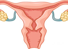 最新试管婴儿资讯:多囊卵巢女性做试管婴儿成功率突破65%的秘诀!