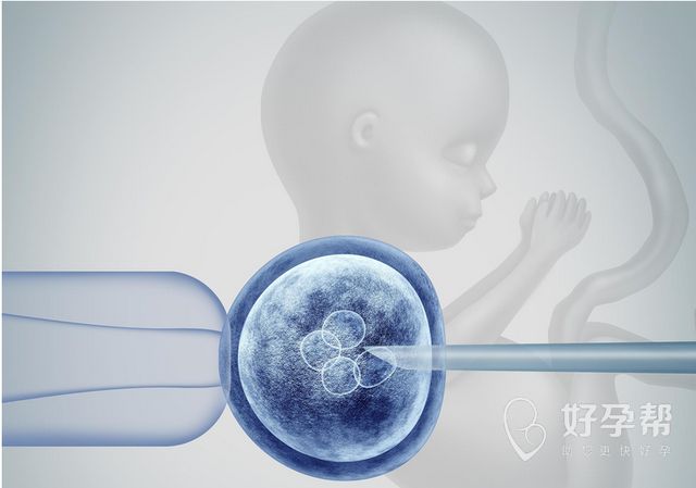 一文解读试管促排卵：多久可以取卵?期间能否过夫妻生活?