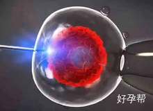 2025年试管费用一览：人工授精与试管婴儿全部花费参考