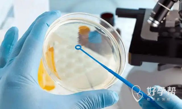 哪些情况需要做试管婴儿?哪种情况建议尽早做试管?