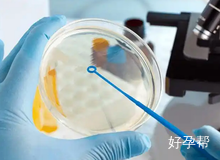 哪些情况需要做试管婴儿?哪种情况建议尽早做试管?