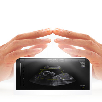 北医三院做试管婴儿需要多长时间才能移植成功?周期需几天!