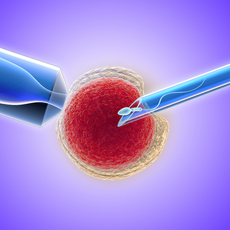 在泰国生殖医院做第3代试管包成功的案例分享：开启全新幸福篇章
