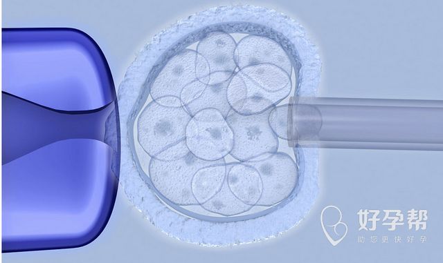大连市妇女儿童医疗中心人工受孕成功率能达到多少?