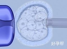 大连市妇女儿童医疗中心人工受孕成功率能达到多少?