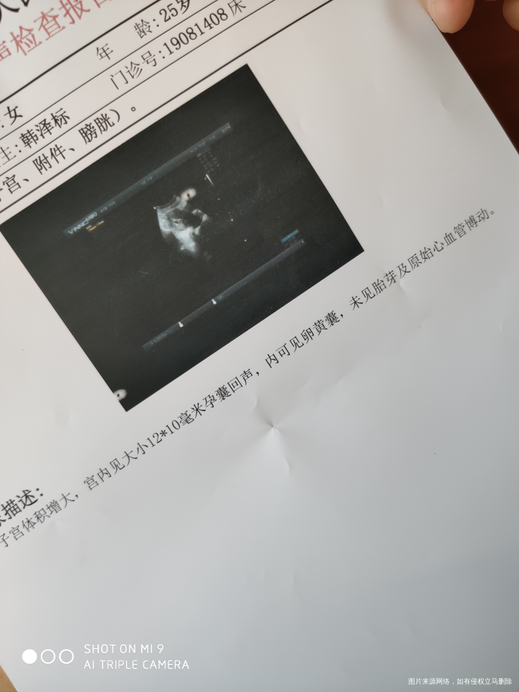 孕八周,肚子偶尔有下坠,隐隐痛的感觉