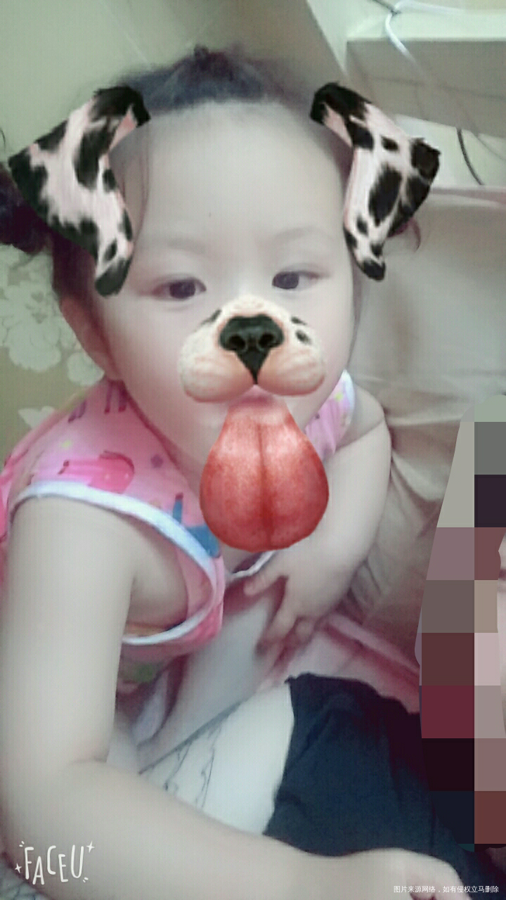 【说一说我的剖腹产经历】