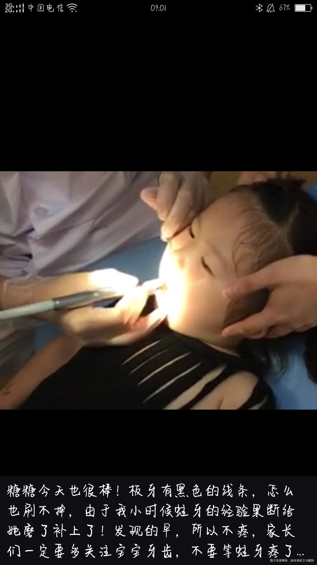 【我和宝贝的补牙经历】一定要关爱口腔健康