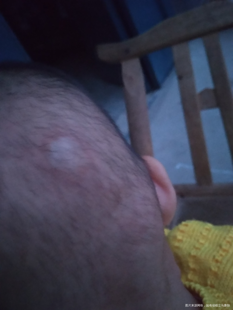 秋天的蚊子这么厉害😡