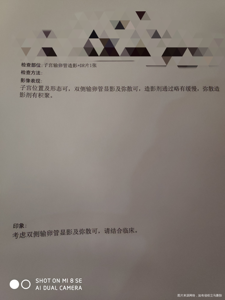 帮忙看一下 输卵管有什么问题吗