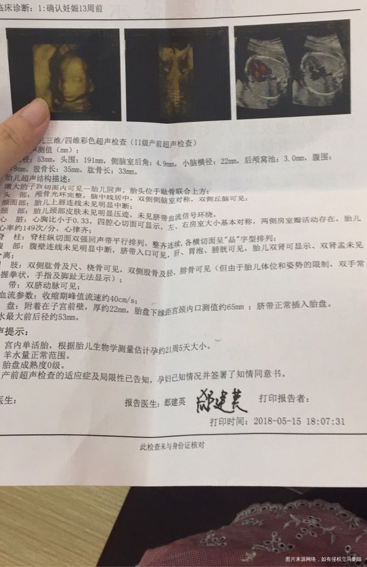四维看看正常吗?时间做了蛮久宝宝之前一直趴着,后来走了楼梯才完成