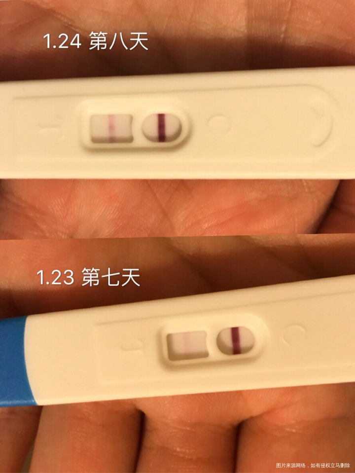 移植第八天,为何这两天胸不肿痛了