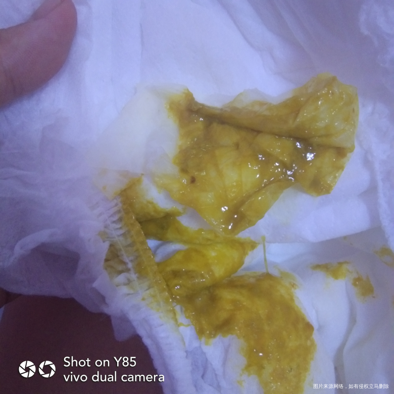 宝宝大便一天五六次是乳糖不耐受吗