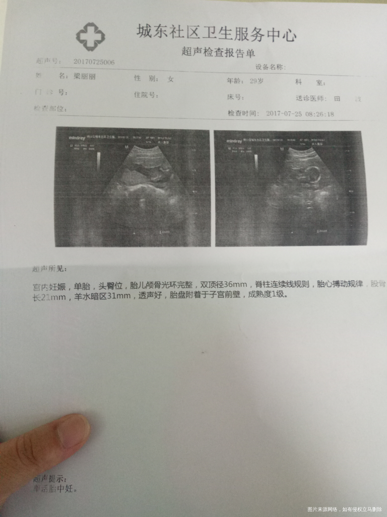 今天检查的结果怎么成熟度1度啊,