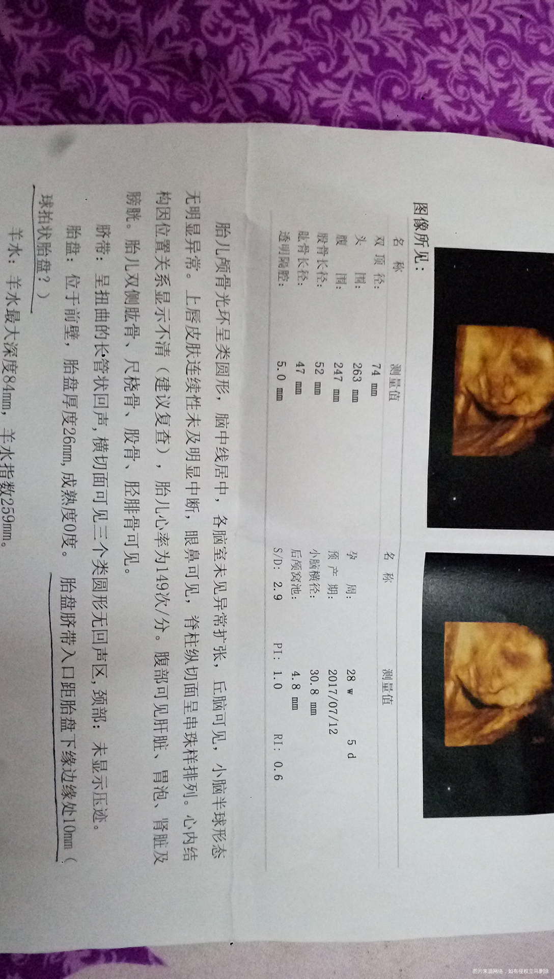 路过的医生,帮帮忙给看看