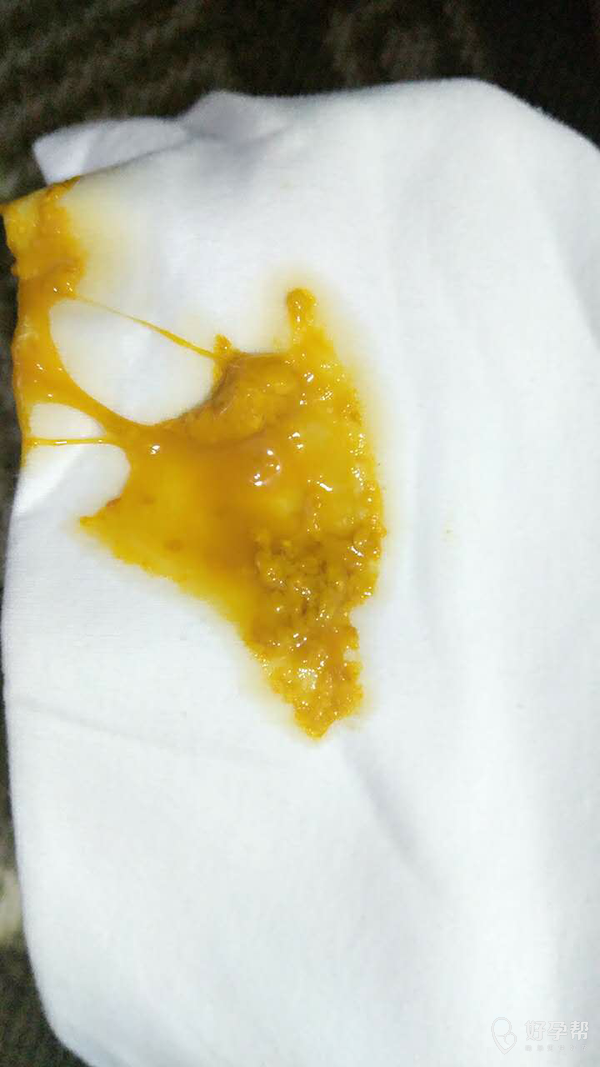 鼻子感觉老是不通,有乳白色鼻屎(特别哭起来严重)今天大便有粘性东西