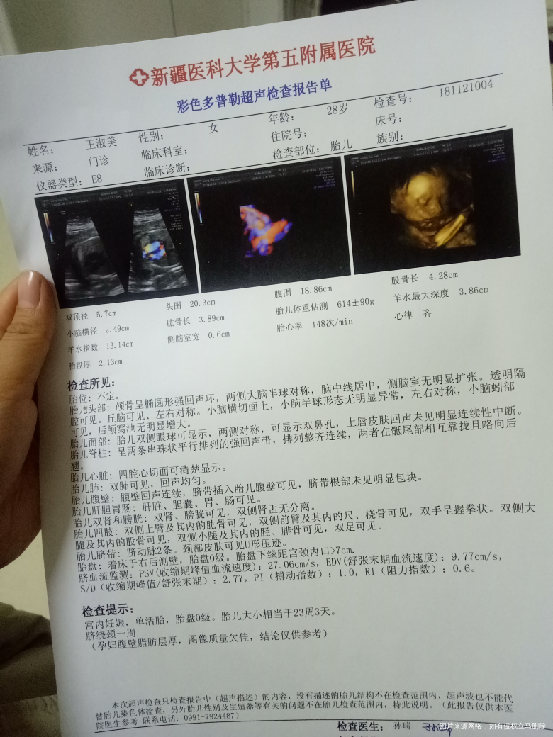 麻烦医生帮我看下我的四维单子,绕颈一周