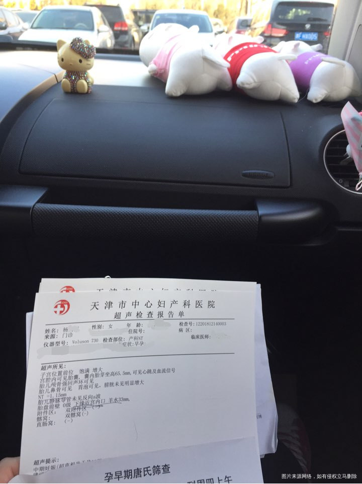 今天做了nt顺利通过了,就是胎盘低,医生说现在周期小所以低,以后应该可以涨上去的...